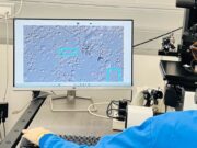 La IA de SpermSearch AI accelera la localització d’espermatozoides en pacients amb infertilitat masculina